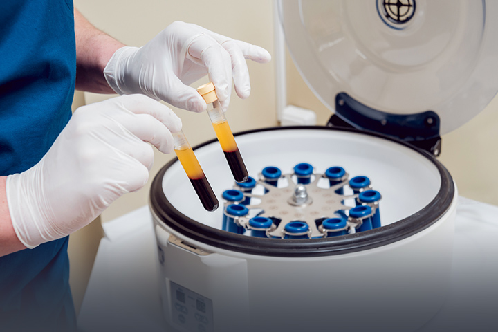 dental implant financing