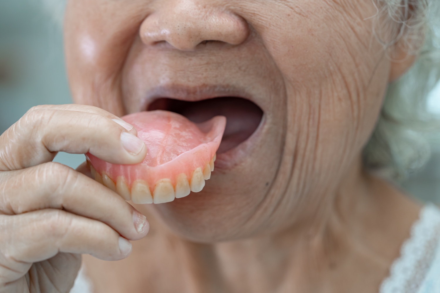 woman inserting a set of dentures