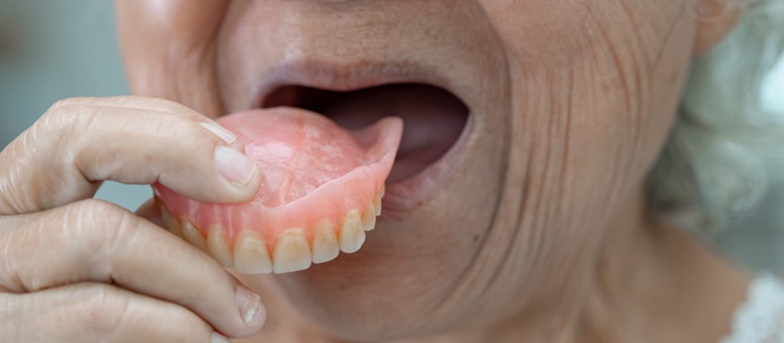woman inserting a set of dentures